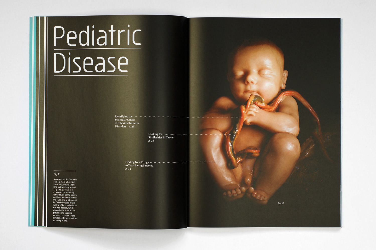 CeMM Report 2011 Pediatric